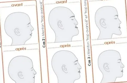 ortognatică