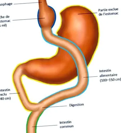 funkcionális