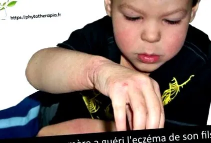 acolo