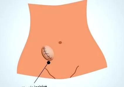tratamentul