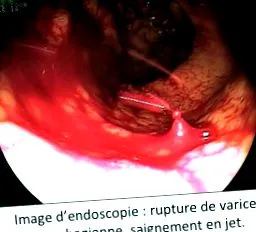 gastro-intestinală