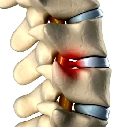 disc