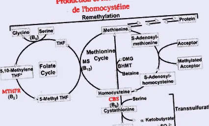 Carson Homocystinuria