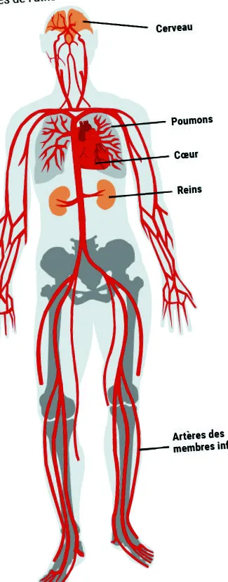 atherosclerosis kockázati tényező