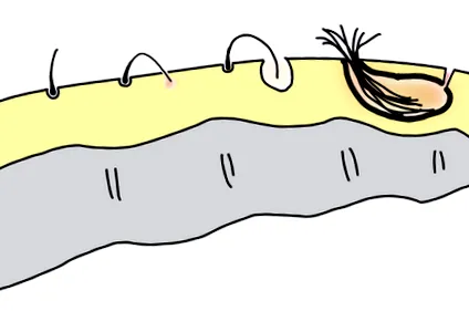 sacrococcigian