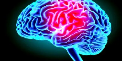 epilepsia