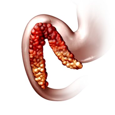crude pancreatice