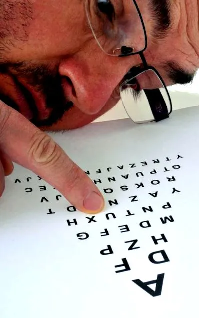 astigmatism