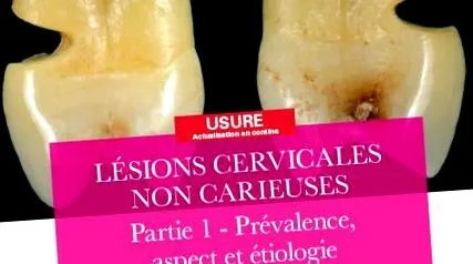 cervicale