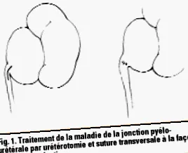 tratamentul