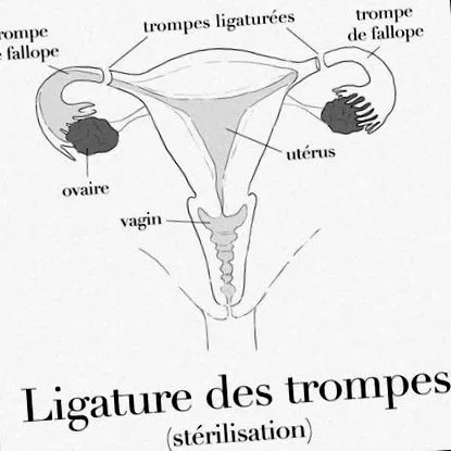 trompelor