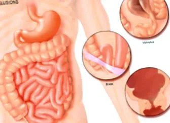 digestiv