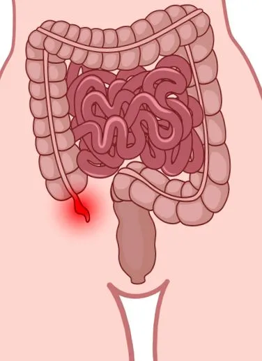 операція