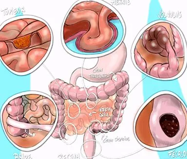 intestinală