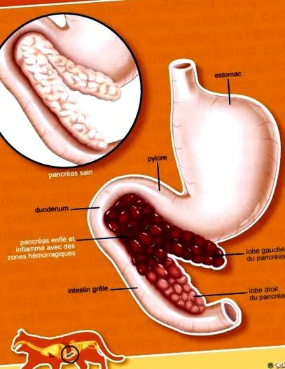 pancreatitei simptomul