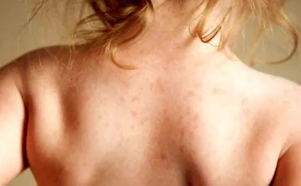 privind pediatrie