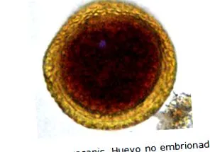 visceralis