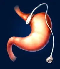 benzii plasarea