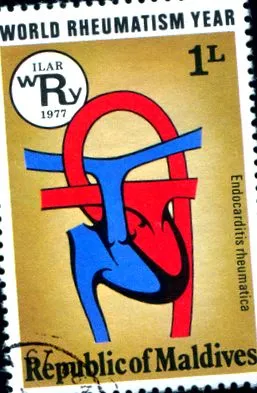 cardiovascular
