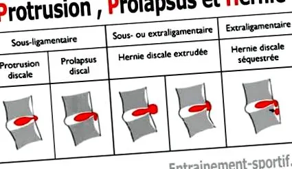 proeminența