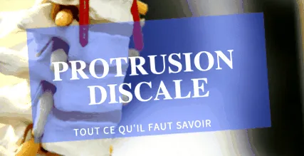 protruziune