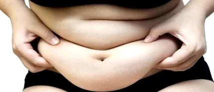 tratamentul obezității