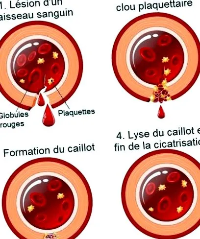 hemosztázisos rendellenességek hemosztázisos rendellenességek