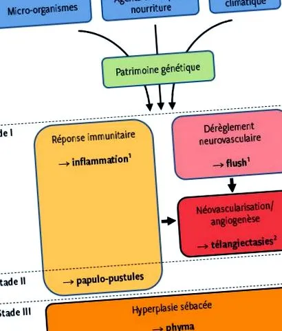 rosacea