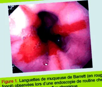 epidemiologia