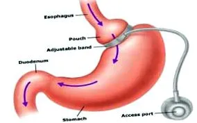 chirurgie
