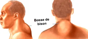 bizoni