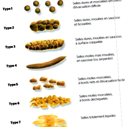 bélrendellenességek