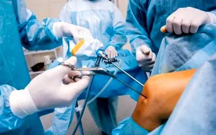 arthroscopy