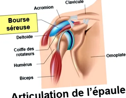 bursitis hogyan