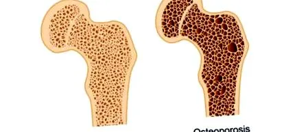densitatea