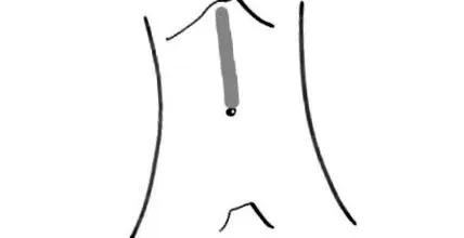visceralis visceralis