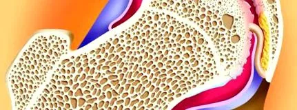 igény osteoarthritis