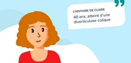 diverticuloză
