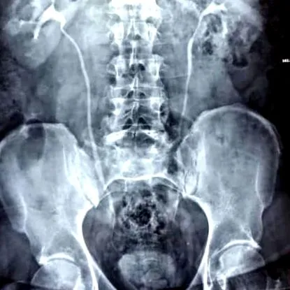 urinar