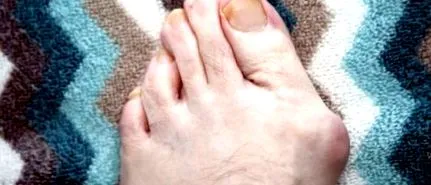 kezelés