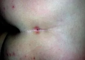 visceralis