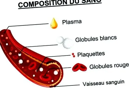 anemia