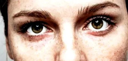 emdr