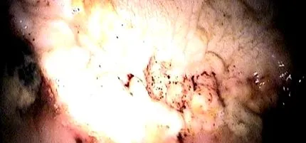 patologie