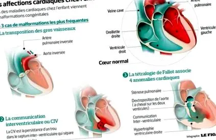 cardiac copii