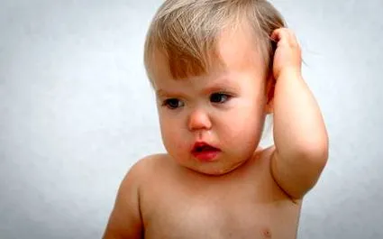 akut otitis