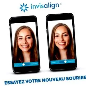invisalign