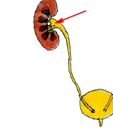 pyelo-ureteralis