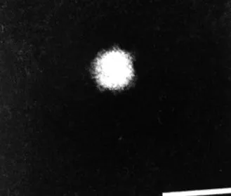 hepatitis vírus