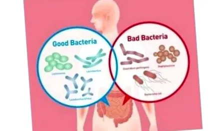 transzplantáció